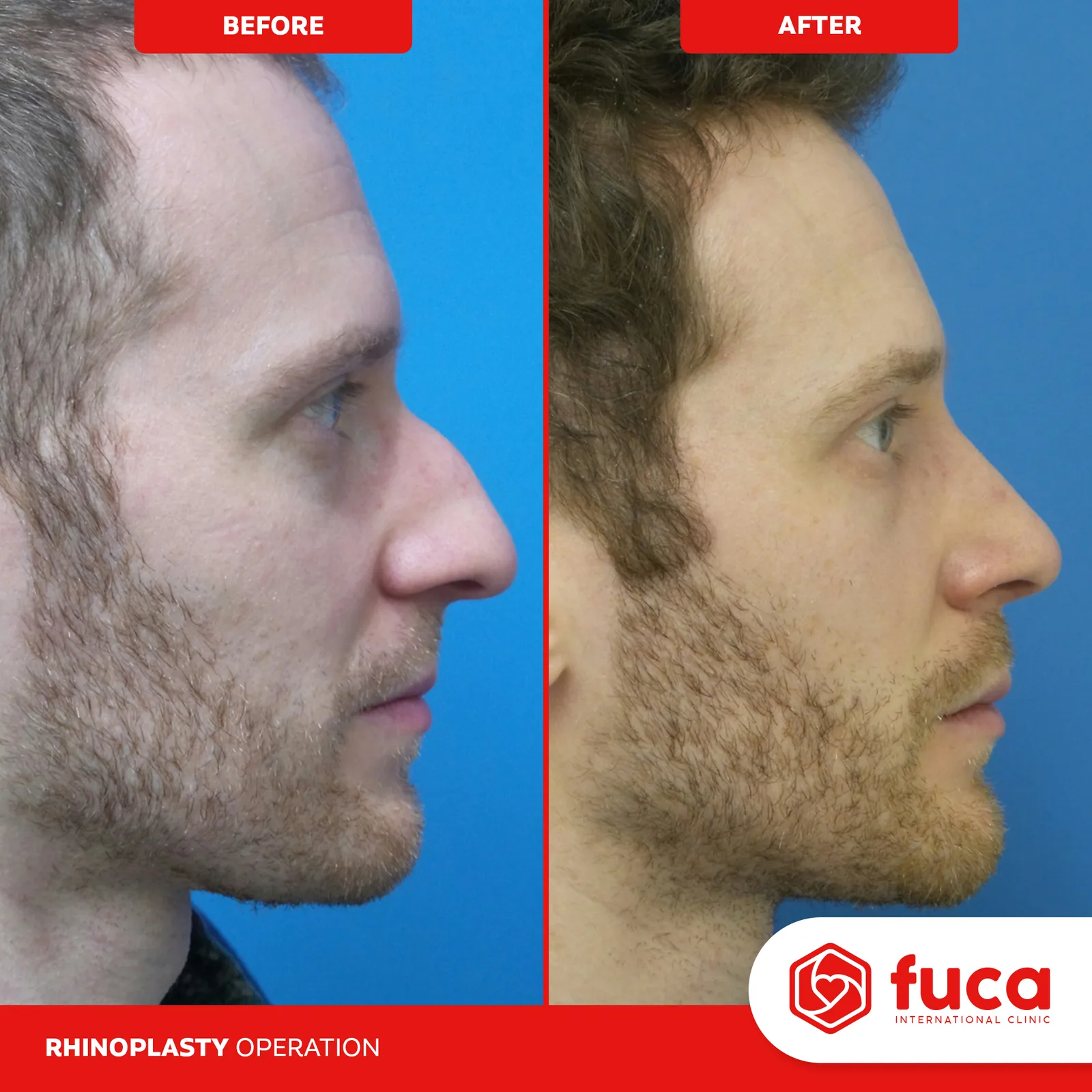 FUCA CLINIC LOGO TASARIMI